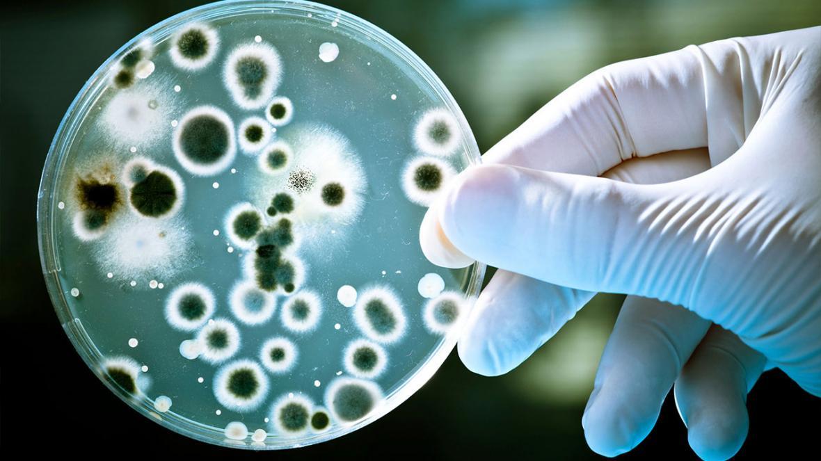 زیست حسگر الکتروکرومی برای تشخیص چشمی باکتری های بیماری زا طراحی شد